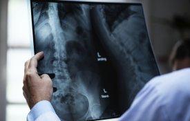 População de Alcanhões protesta pela falta de médico de família