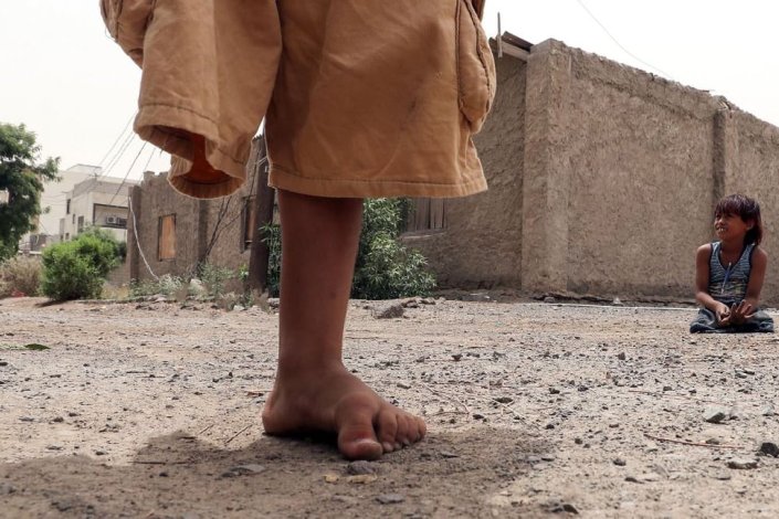 Duas crianças Iemenitas, estropiadas por minas antipessoais, brincam na cidade de Aden, Iémen, uma zona ocupada pelas forças sauditas, com o apoio norte-americano e britânico. 9 de Agosto de 2018