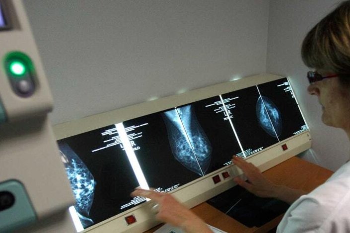 A carreira dos técnicos de diagnóstico e terapêutica «ficou aquém do que é justo», diz Ana Avoila